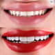 Slider image (10) Jimer Dental Clinics